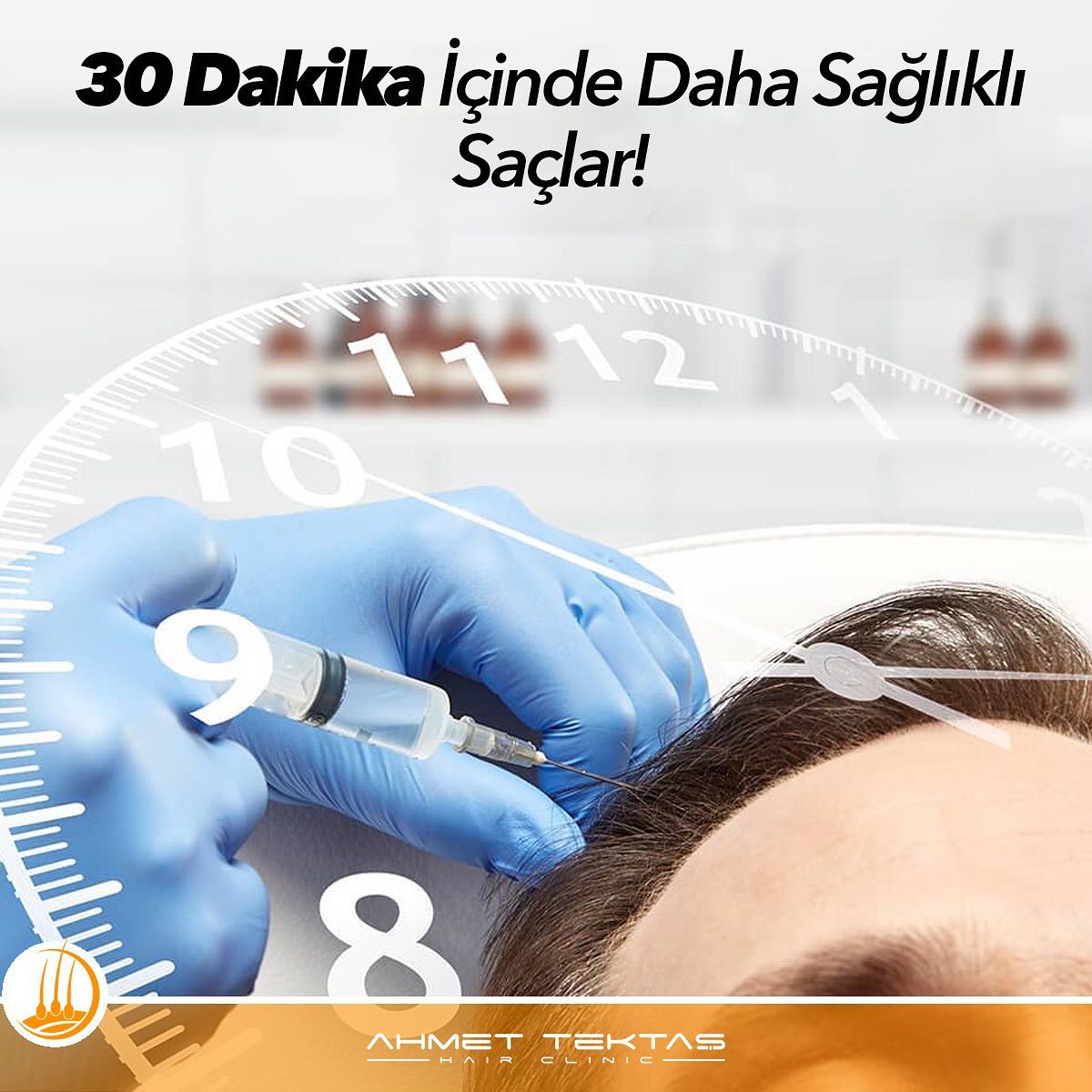 FUE Saç Ekimi