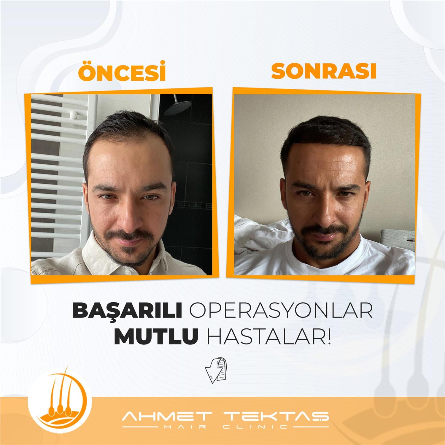 Kayseri Saç Ekimi, Aydın Bey Kayseri Saç Ekimi, Aydın Bey