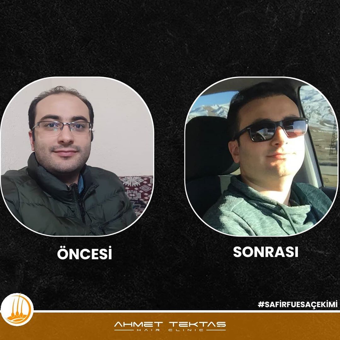 Kayseri Saç Ekimi, İhsan Bey Kayseri Saç Ekimi, İhsan Bey