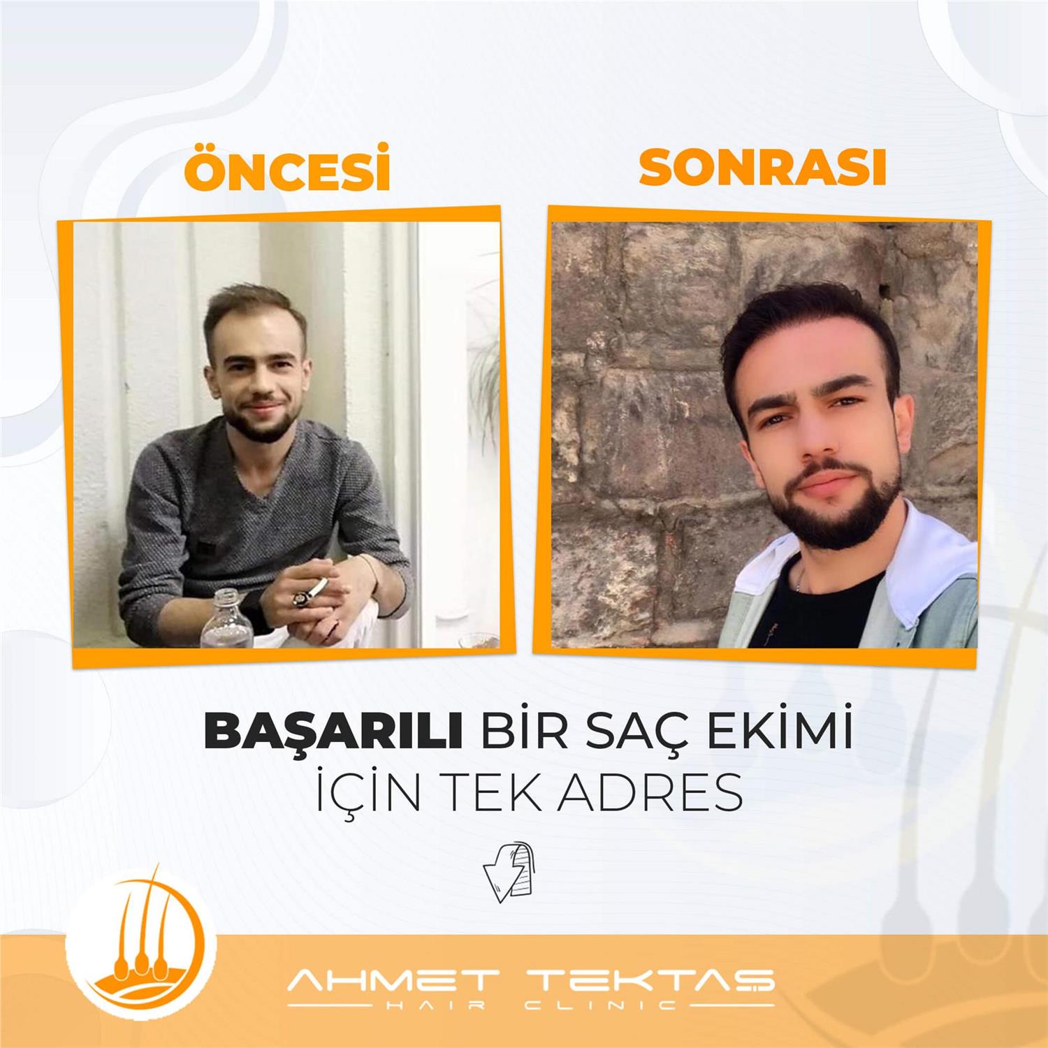 Kayseri Saç Ekimi, Oktay Bey Kayseri Saç Ekimi, Oktay Bey