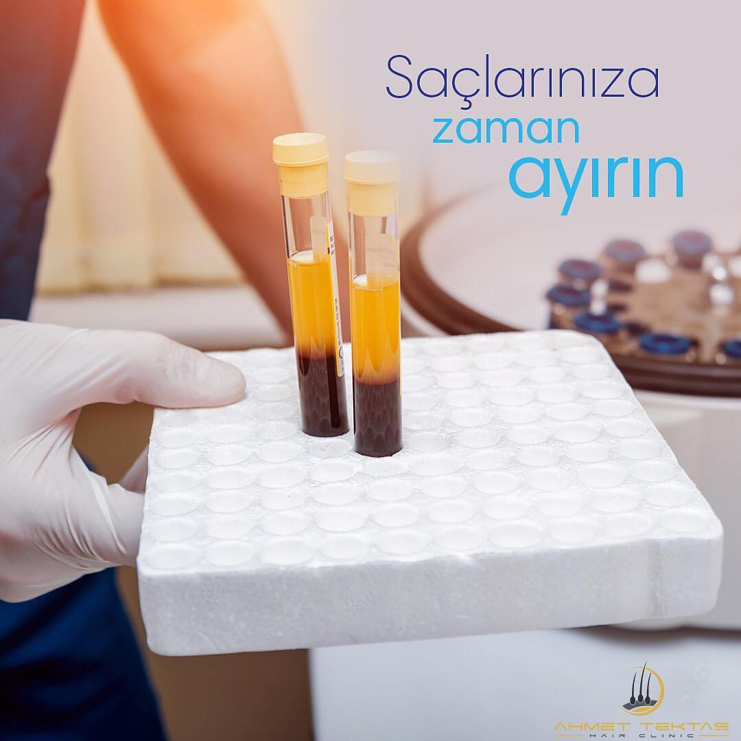 PRP Saç Tedavisi PRP Saç Tedavisi