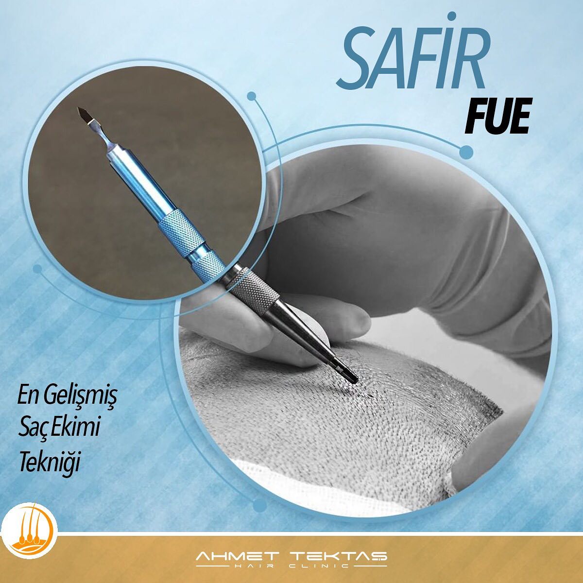 Safir FUE Saç Ekimi