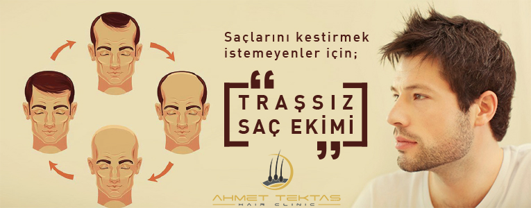 Tıraşsız Saç Ekimi Tıraşsız Saç Ekimi