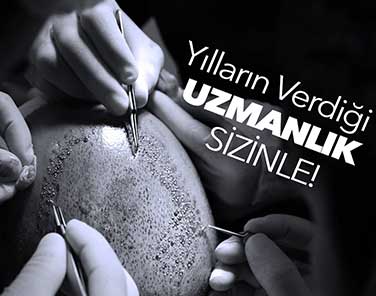 En İyi ve Güvenilir Saç Ekimi Merkezi Tavsiyeleri