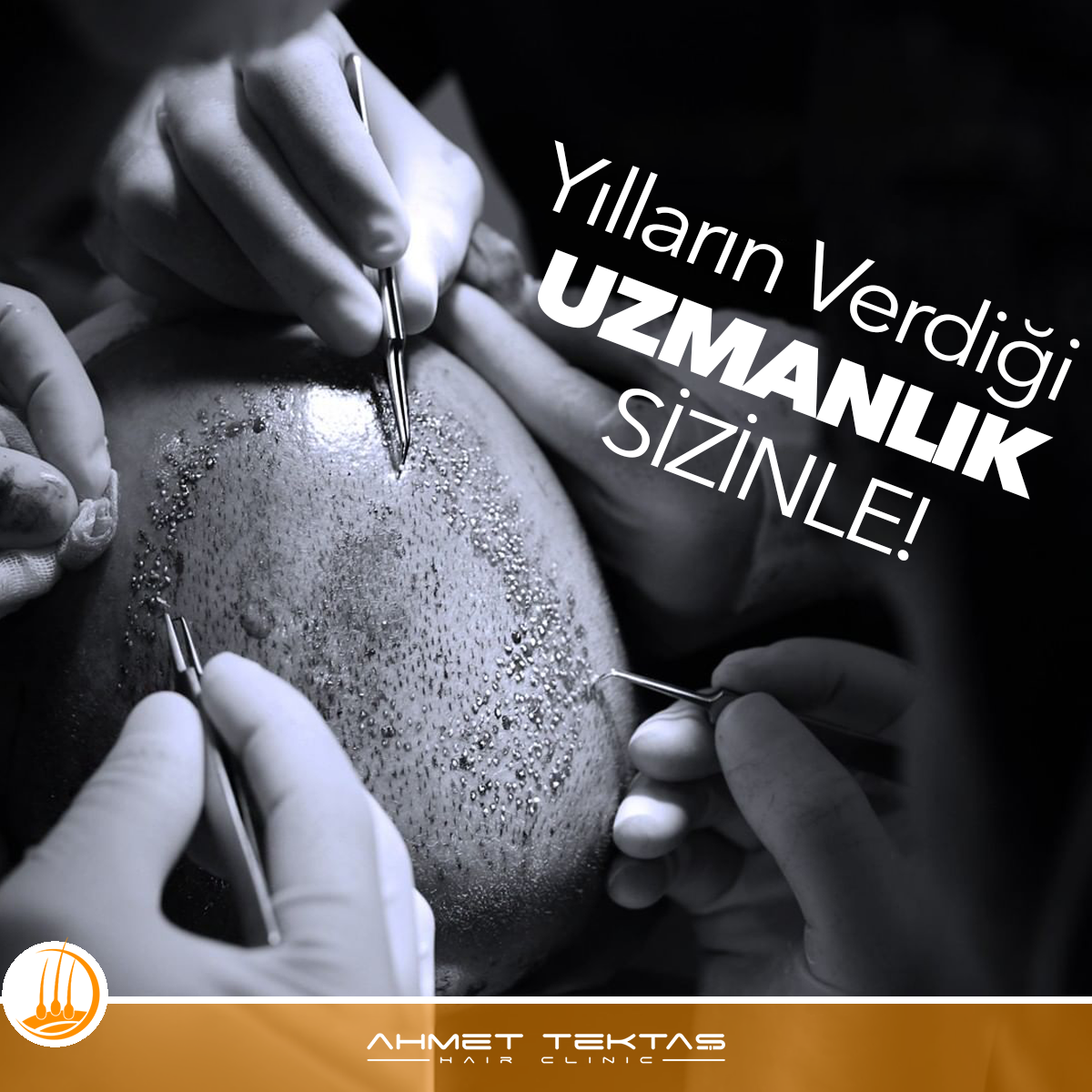 En İyi ve Güvenilir Saç Ekimi Merkezi Tavsiyeleri