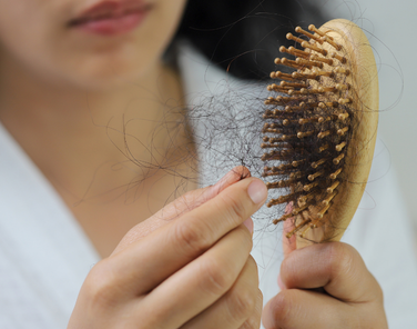 Saç Dökülmesi Nasıl Önlenir