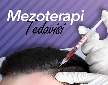 Saç Mezoterapisi